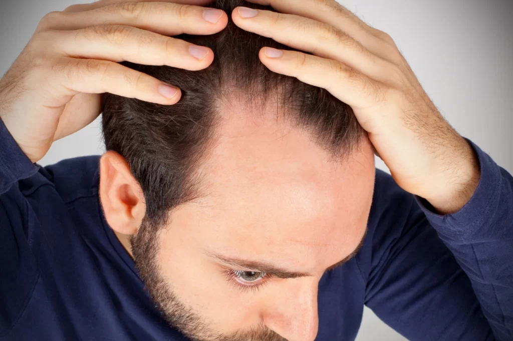 Why Is My Hair Shedding So Much